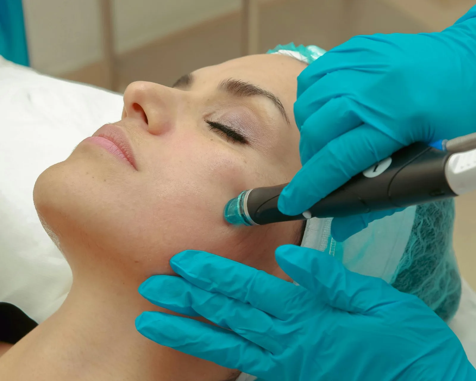 Botox before reference image at Forever Glow Aesthetics & Wellness in Leander, TX