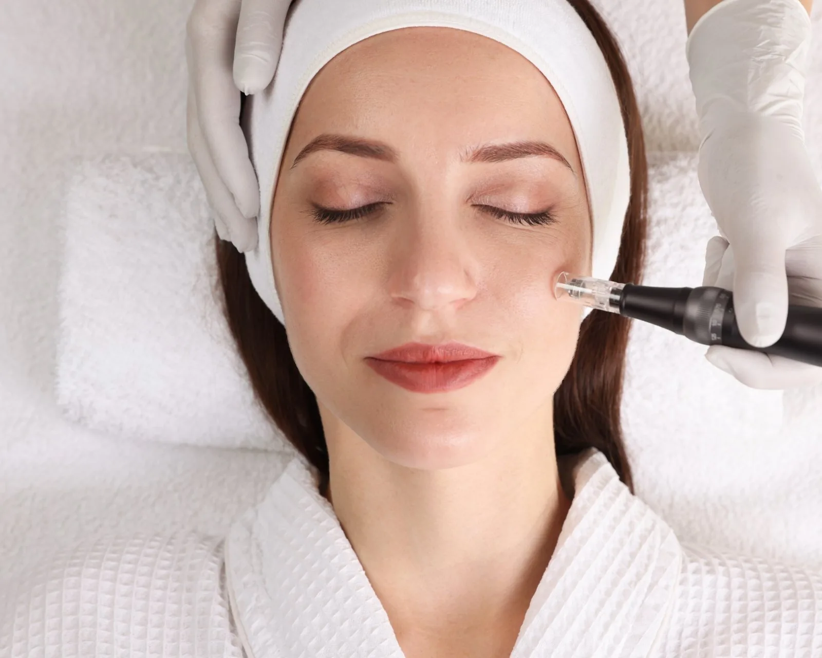 Microneedling before reference image at Forever Glow Aesthetics & Wellness in Leander, TX
