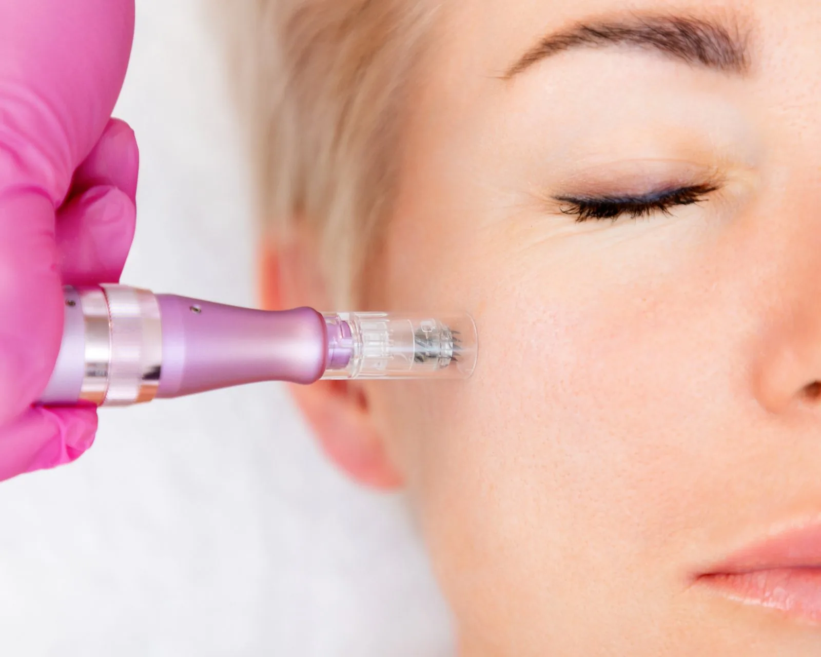 Lip filler before reference image at Forever Glow Aesthetics & Wellness in Leander, TX