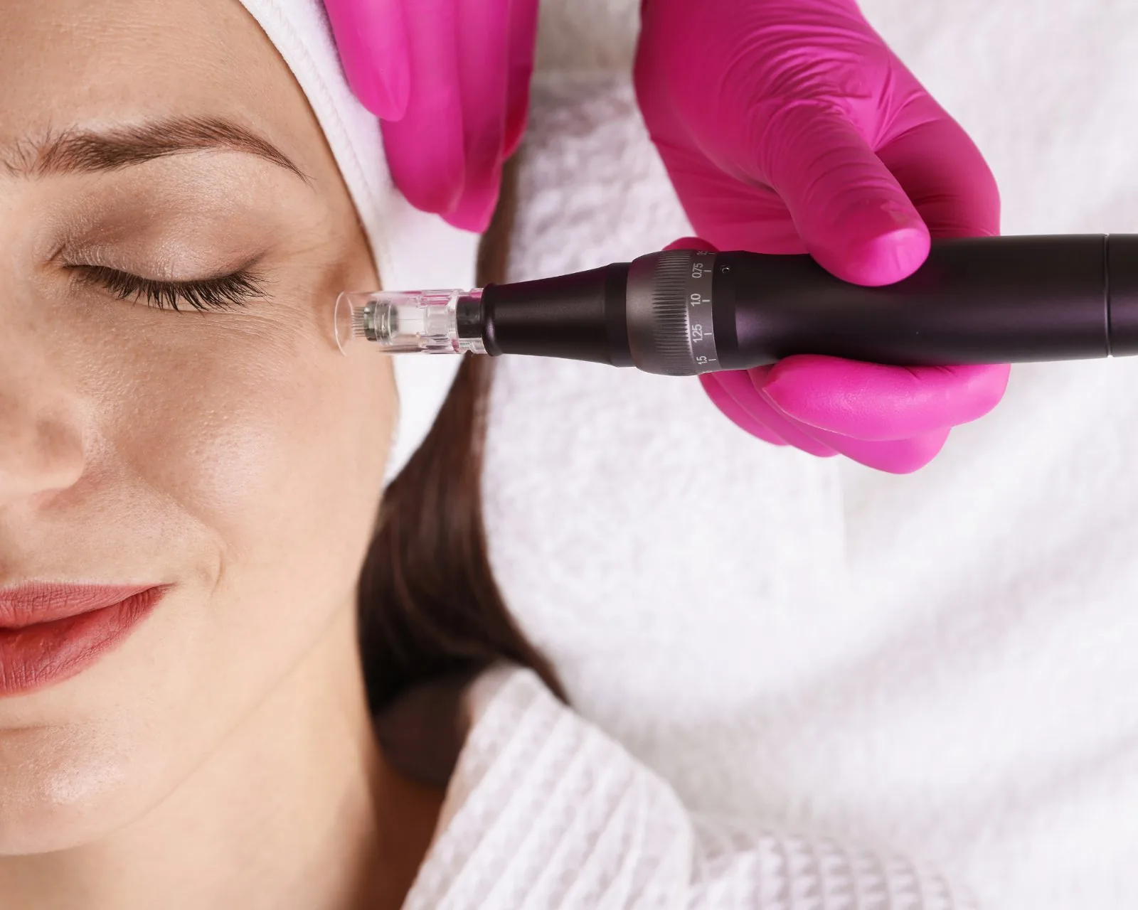 Cheek filler before reference image at Forever Glow Aesthetics & Wellness in Leander, TX