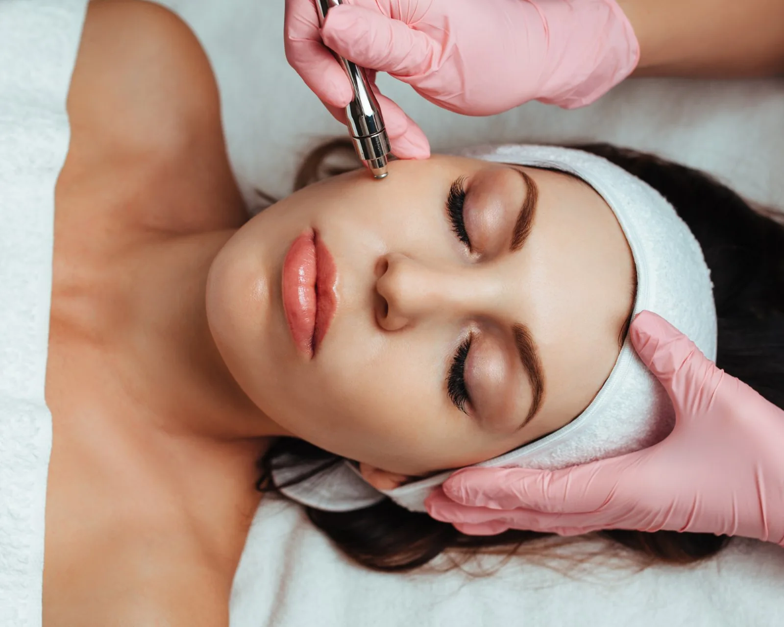 Microneedling after reference image at Forever Glow Aesthetics & Wellness in Leander, TX