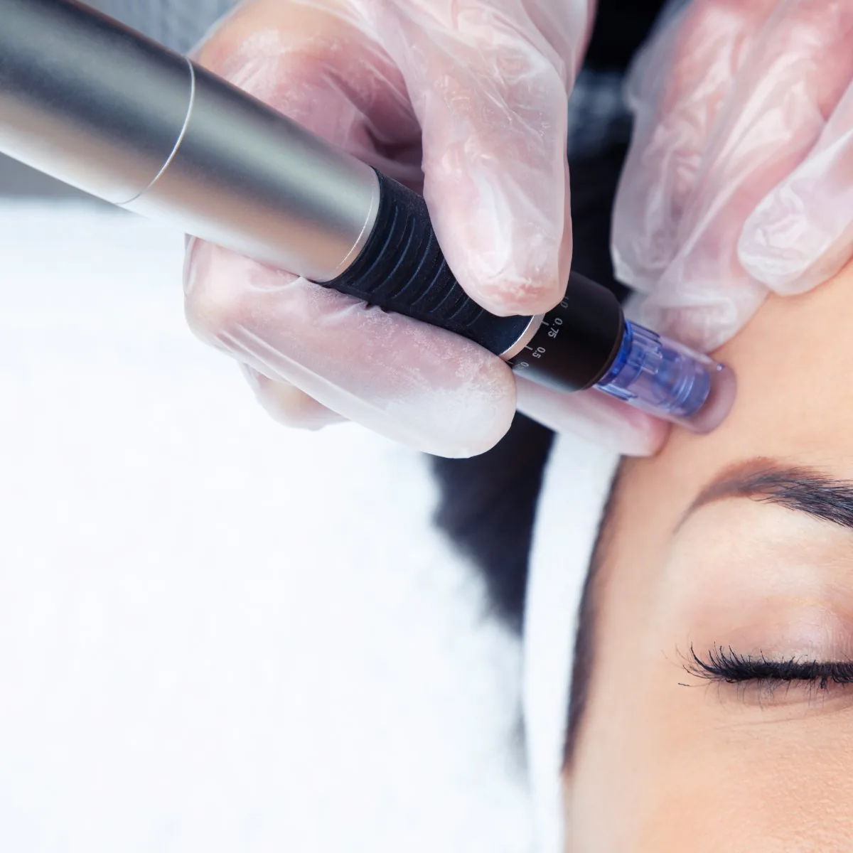 Microneedling pen used for collagen-stimulating skin rejuvenation at Forever Glow Aesthetics & Wellness, Leander TX