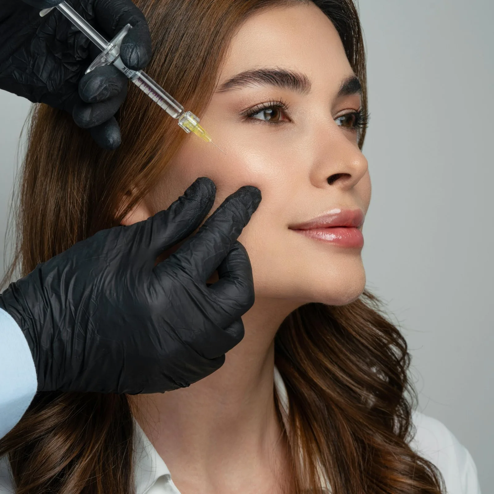 Cheek filler after reference image at Forever Glow Aesthetics & Wellness in Leander, TX