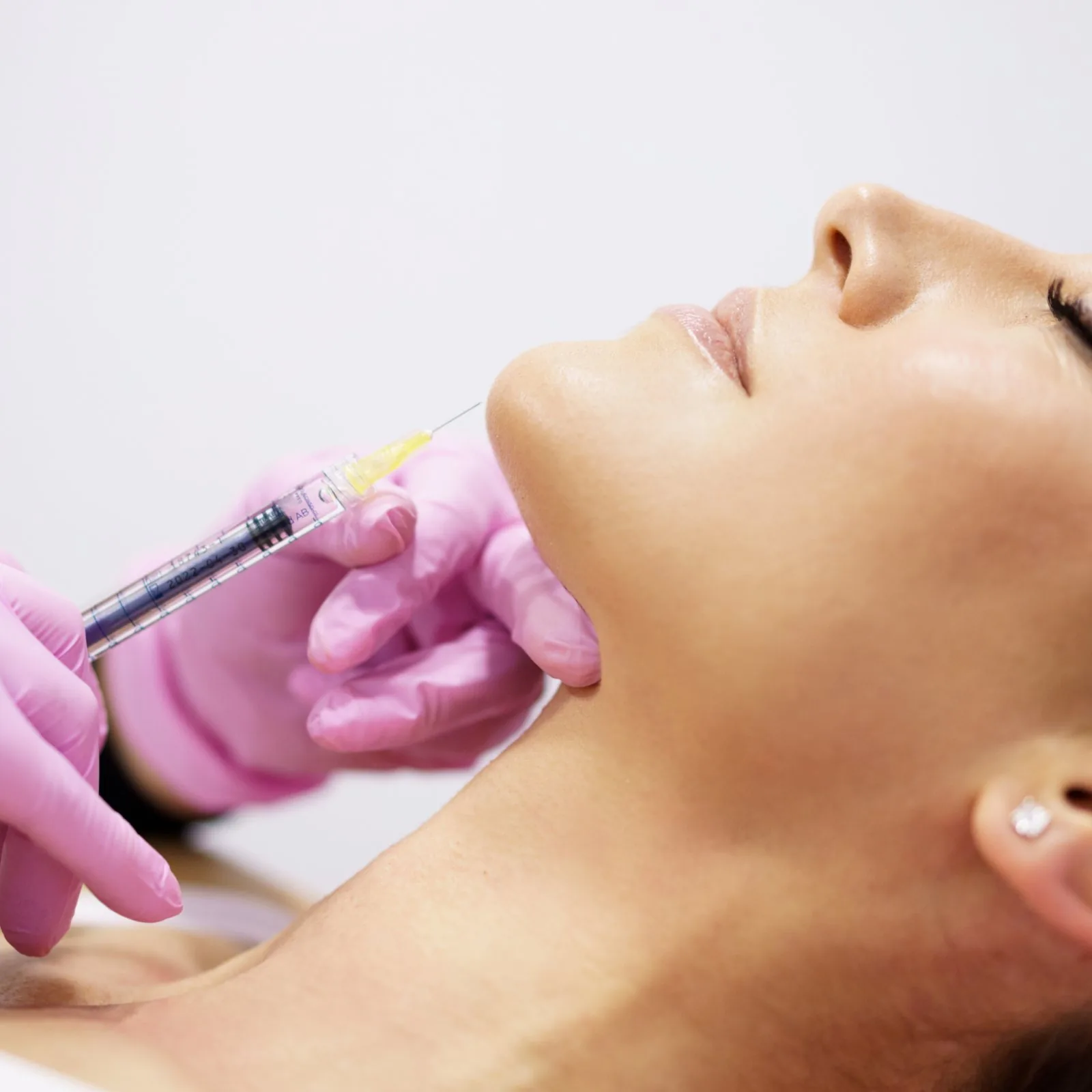 Lower-face close-up for chin tox treatment in Leander, TX