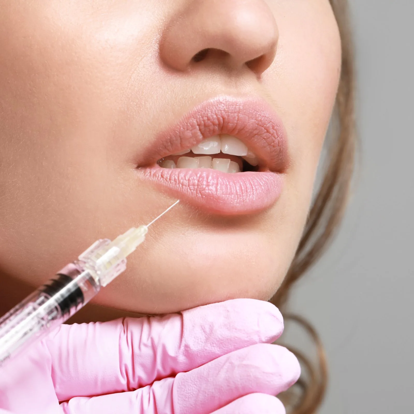 Lip filler after reference image at Forever Glow Aesthetics & Wellness in Leander, TX