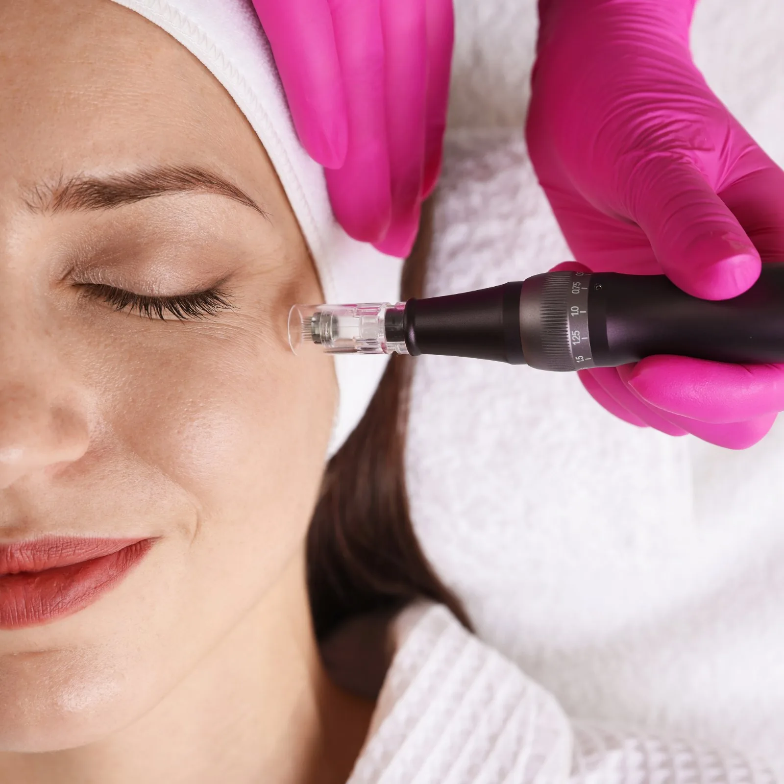 Microneedling with PDRN: Why Salmon DNA Is Trending